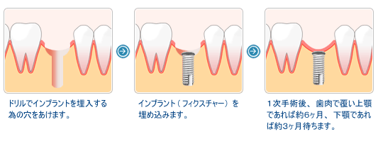 �켡��Ѥ�ή��