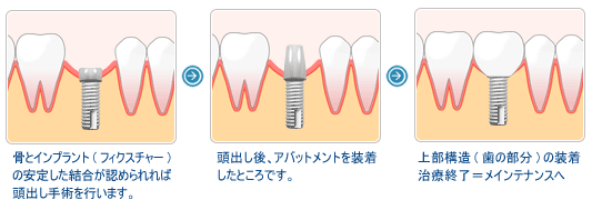 �󼡼�Ѥ�ή��