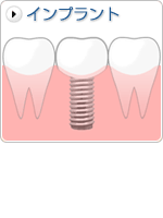 ����ץ���