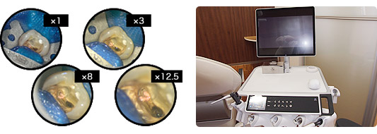 �ޥ������������סʼ��θ������ˤ���Ѥ�������