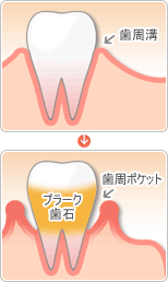 �����¡������ݥ��å�