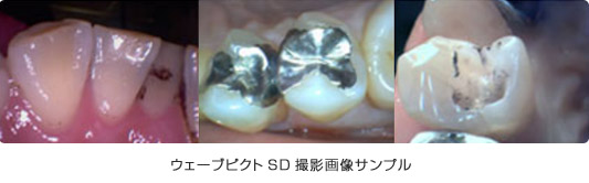 �������֥ԥ���SD���Ʋ�������ץ�